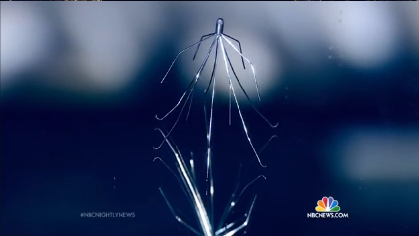 NBC News Discusses Problems with Defective IVC Filters