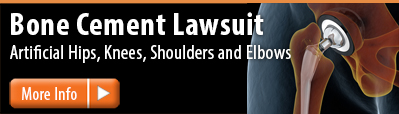 Bone Cement Failure Lawsuit