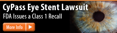 CyPass Eye Stent Lawsuit