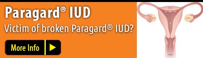 Paragard® IUD Birth Control-Device