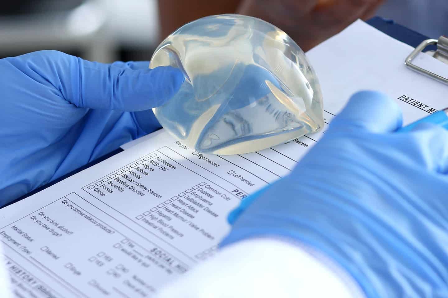 allergan-biocell-textured-breast-implant-defective-medical-device